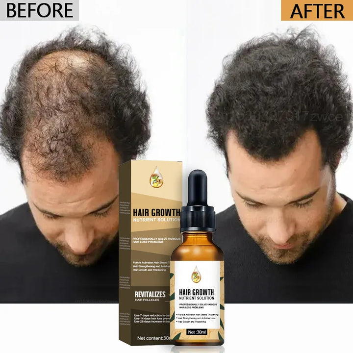 Natural Hair Growth Oil Efficient Anti Hair Loss Nourishing Essential Oil For Dense Repair Damaged Hair Moisturizing Smooth Oil