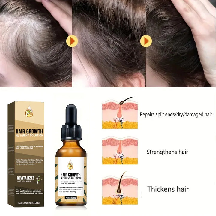 Natural Hair Growth Oil Efficient Anti Hair Loss Nourishing Essential Oil For Dense Repair Damaged Hair Moisturizing Smooth Oil