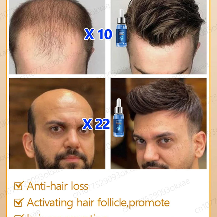 Hair Growth Essence Oil Products Fast Effective Baldness Repair Treatment Anti Hereditary Seborrheic Alopecia Loss For Men Women