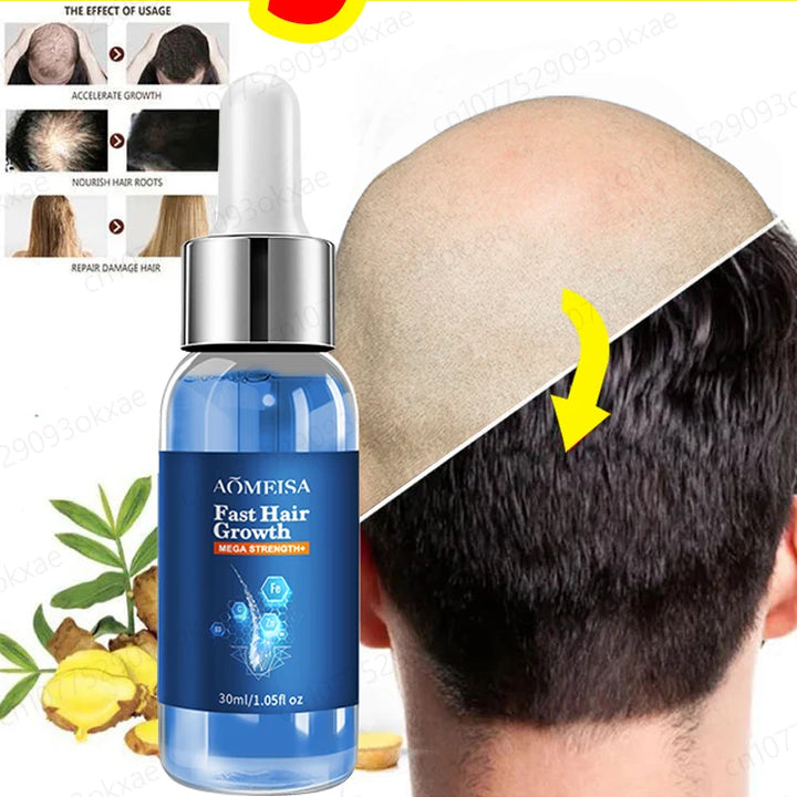 Hair Growth Essence Oil Products Fast Effective Baldness Repair Treatment Anti Hereditary Seborrheic Alopecia Loss For Men Women